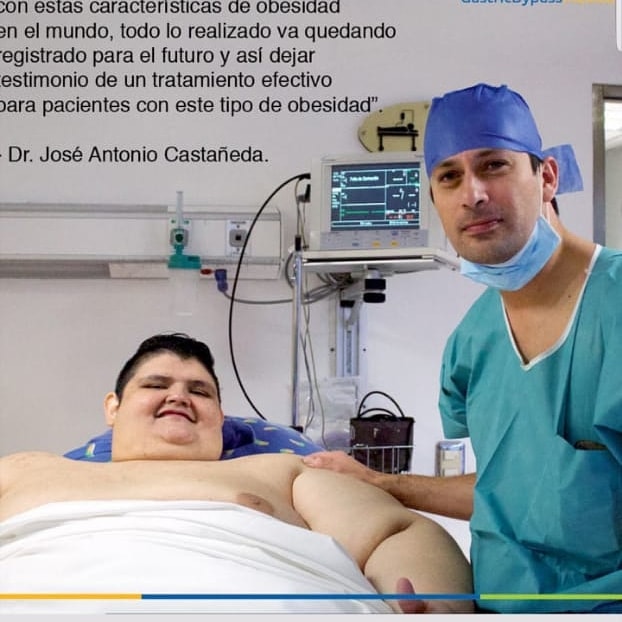 INCREDIBIL. Cel mai gras om din lume a reușit să slăbească 330 de kilograme. Cât cântărește acum și cum arată