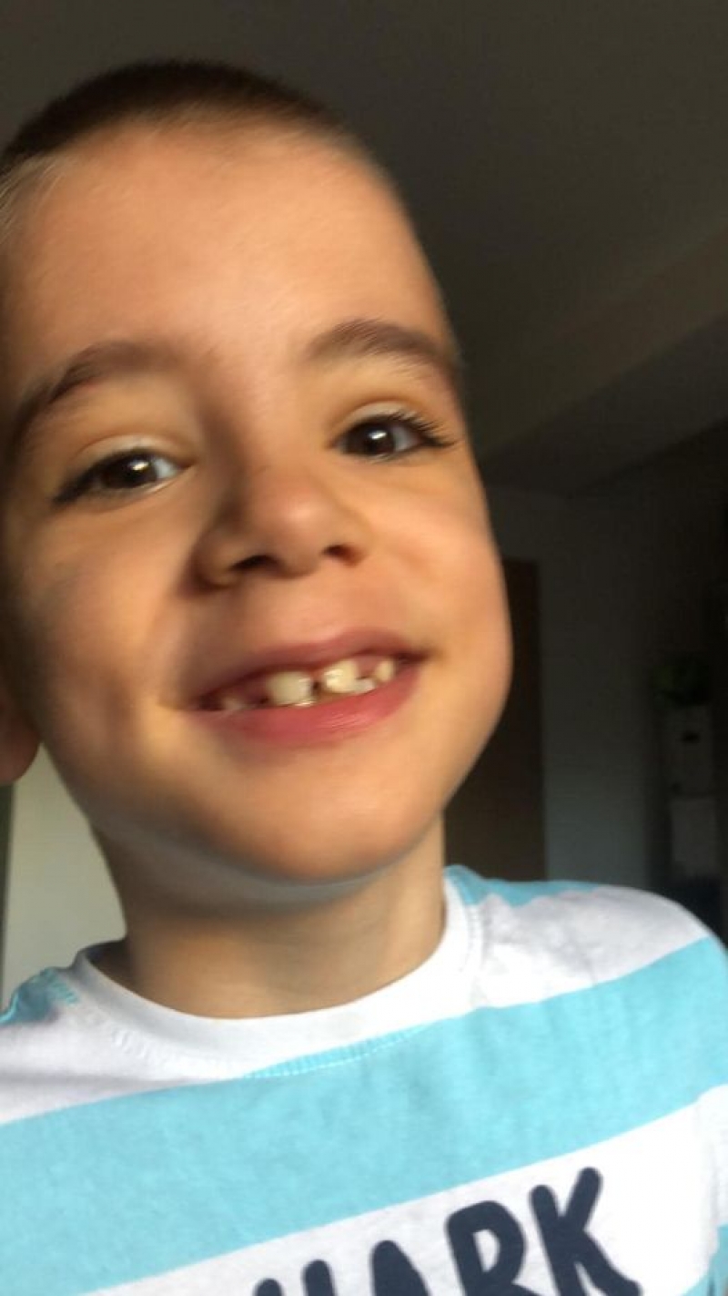 Viața unui copilaș de numai șapte ani stă în cinci mii de euro, pe care nu îi are, ca să se opereze – Apel umanitar