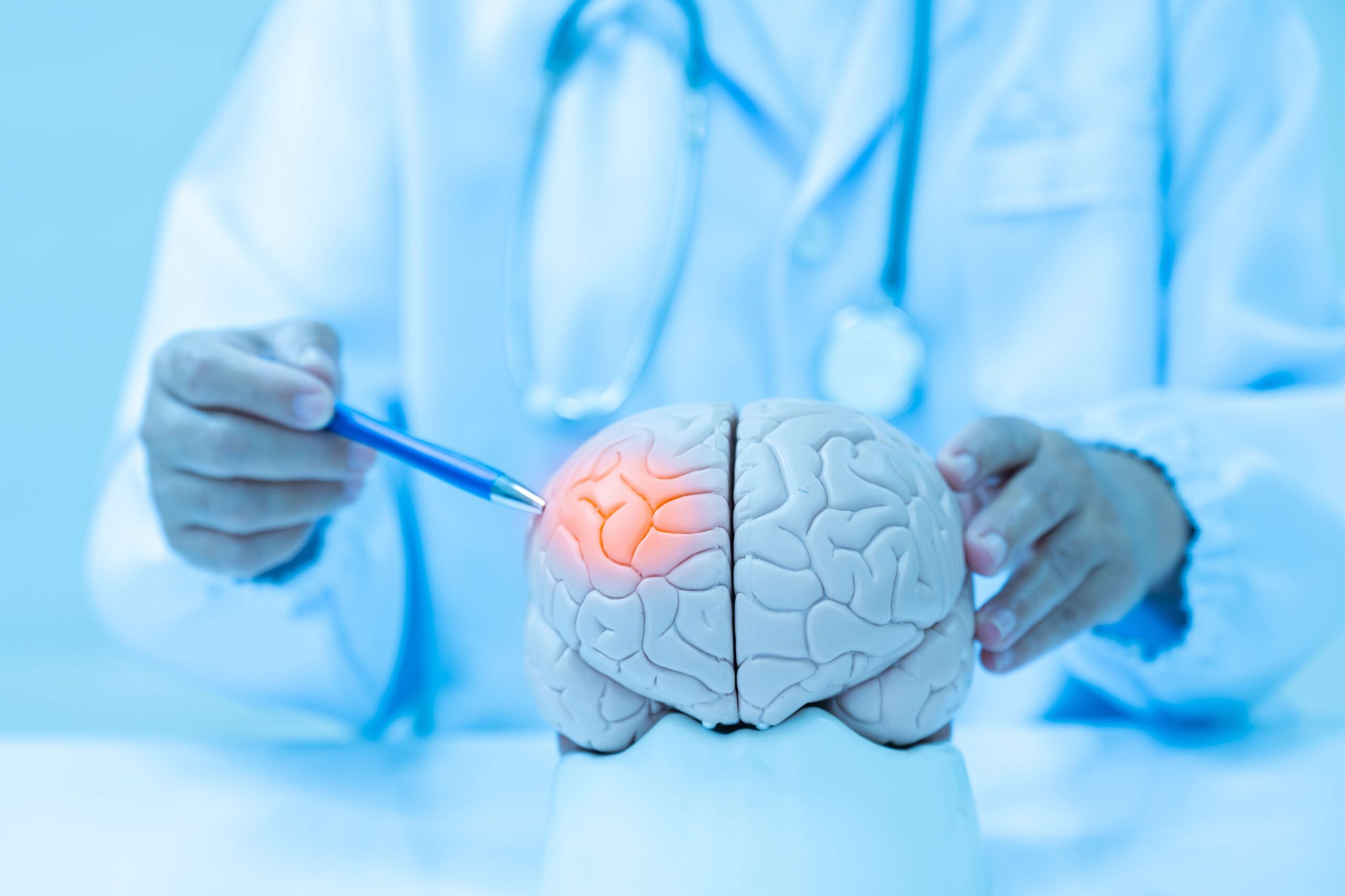 Semnele care pot indica un accident vascular cerebral
