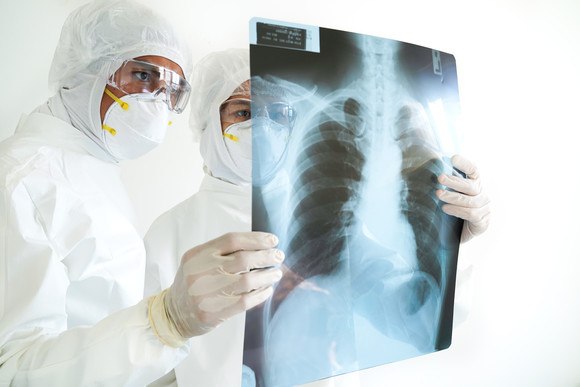 „Sindromul plămânilor albi”, boala misterioasă din China, pare că a ajuns și în România. Simptomele pot fi confundate cu cele ale gripei