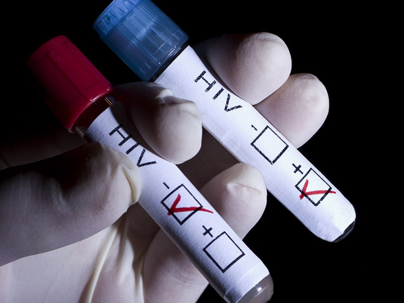 Un studiu recent indică faptul că medicii ar putea ține efectele infectării cu HIV sub control