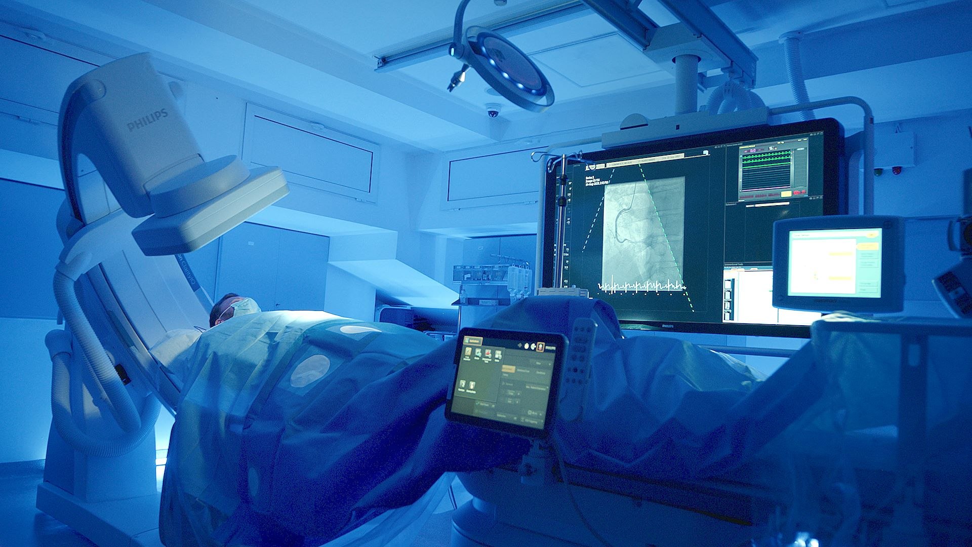 Cum pot fi evitate complicațiile anevrismului de aortă?