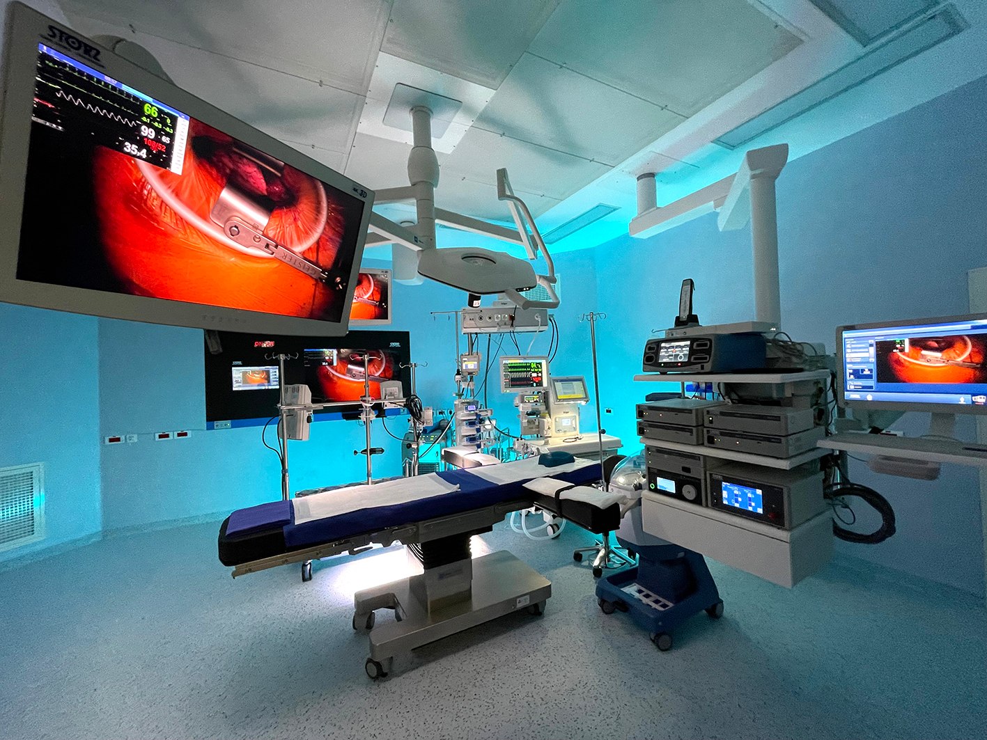 Inteligența artificială, utilizată în chirurgia cardiovasculară minim invazivă, în premieră pentru România