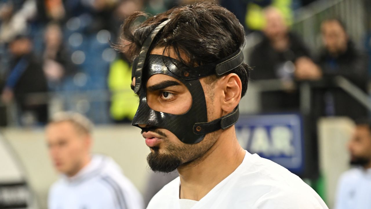 Masca lui Ștefan Baiaram. Fotbalistul Universității Craiova, dezvăluiri despre ‘accesoriul’ pe care e obligat să-l poarte