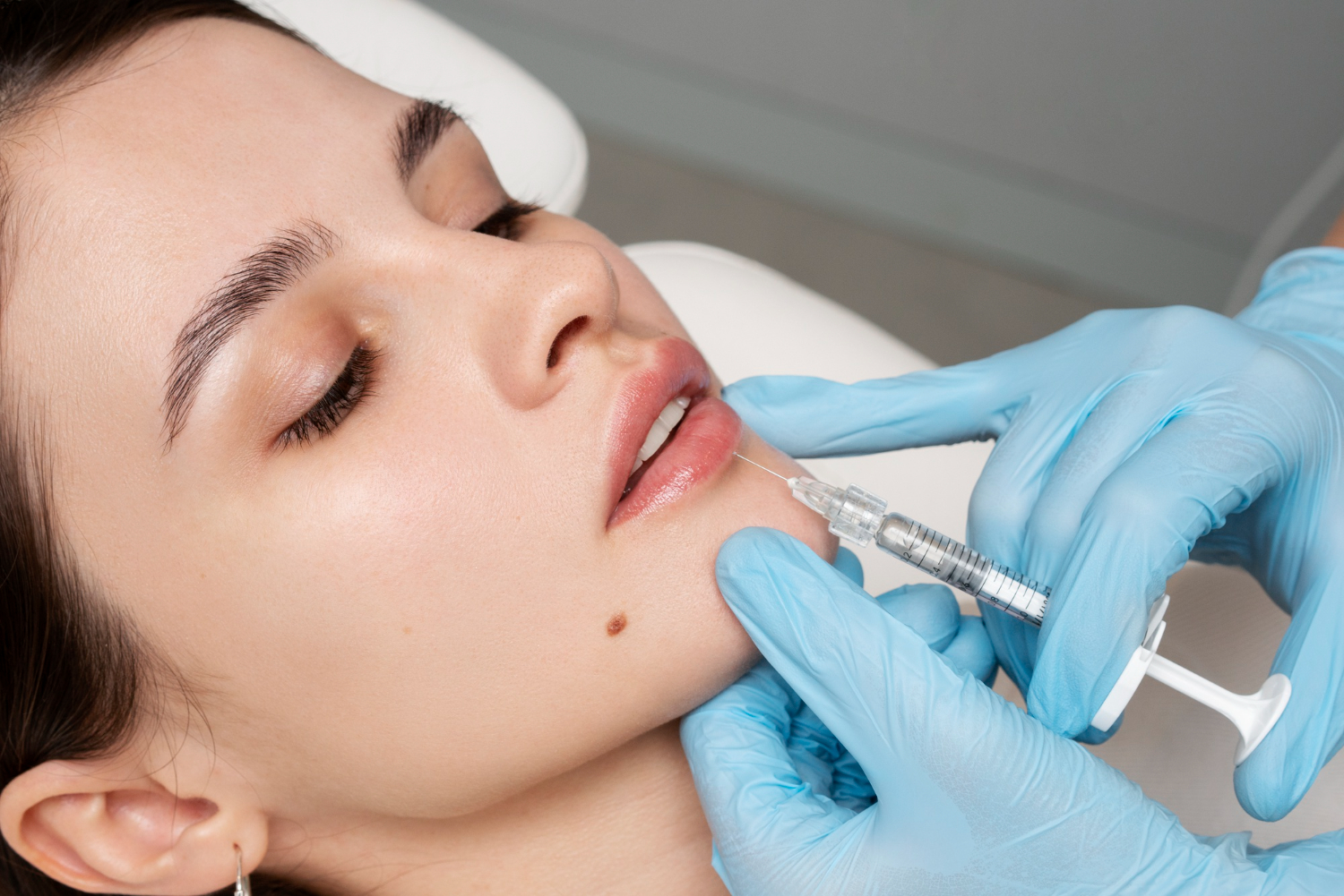 Injectare acid hialuronic București: Beneficii, rezultate și ce trebuie să știi înainte de procedură