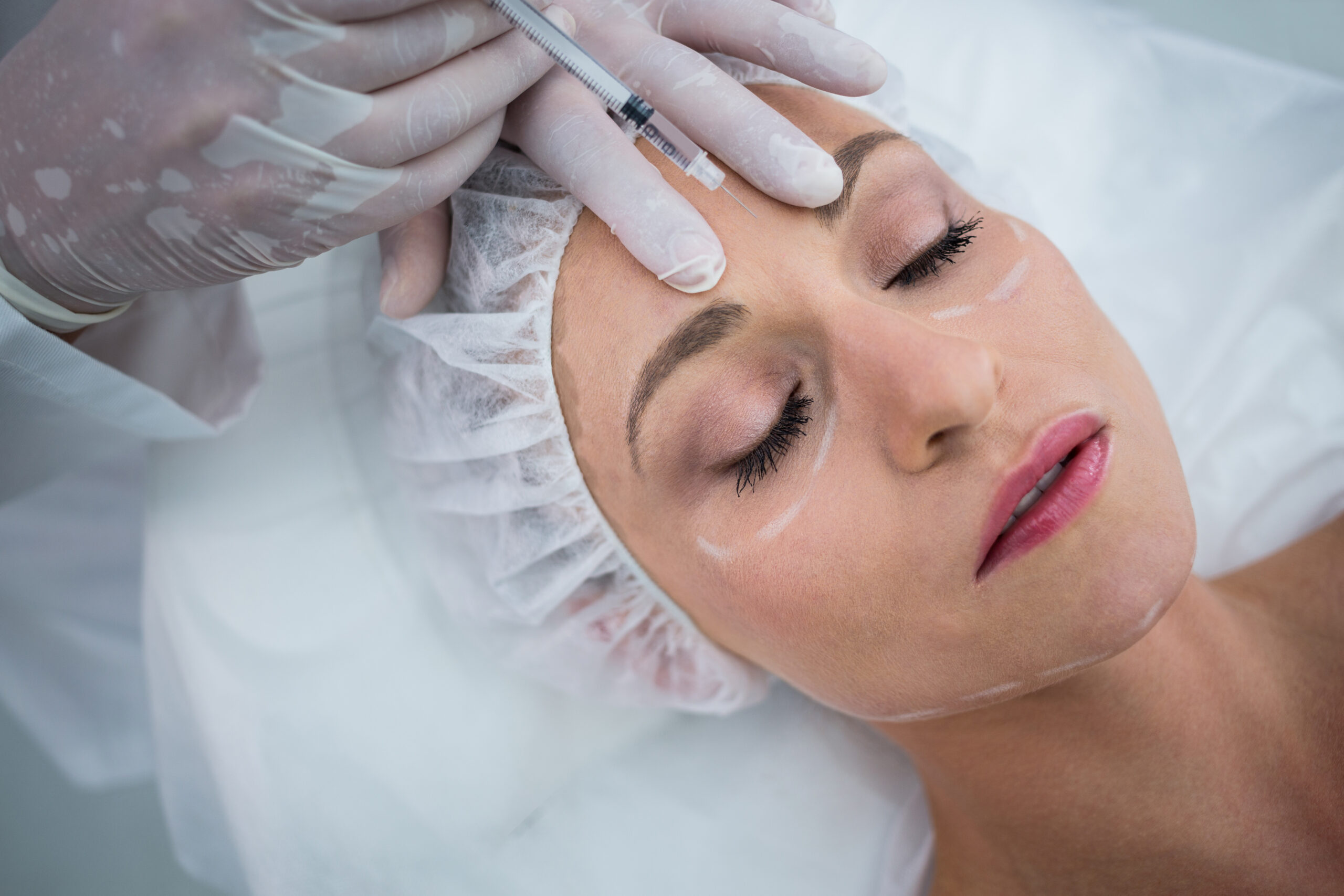 Toxina botulinică: mituri vs realitate. Ce face de fapt Botox-ul și ce nu face